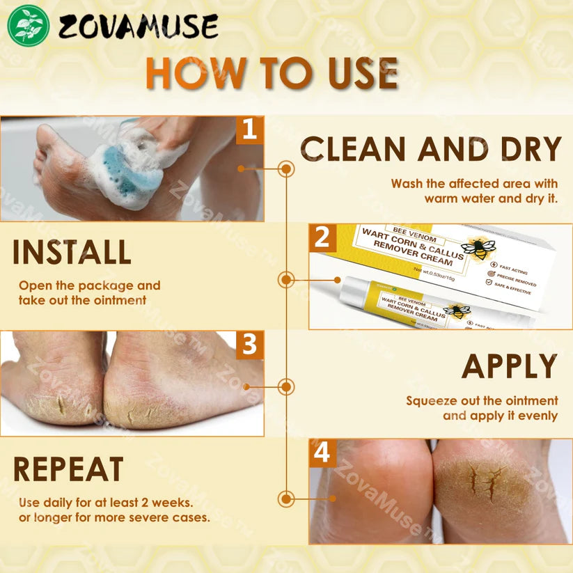 Bee Venom Corn & Callus Remover Cream