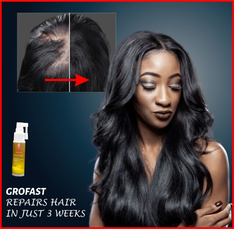 GroFast Herbal Spray--Restore & Grow Back Your Hair🔥🔥🔥