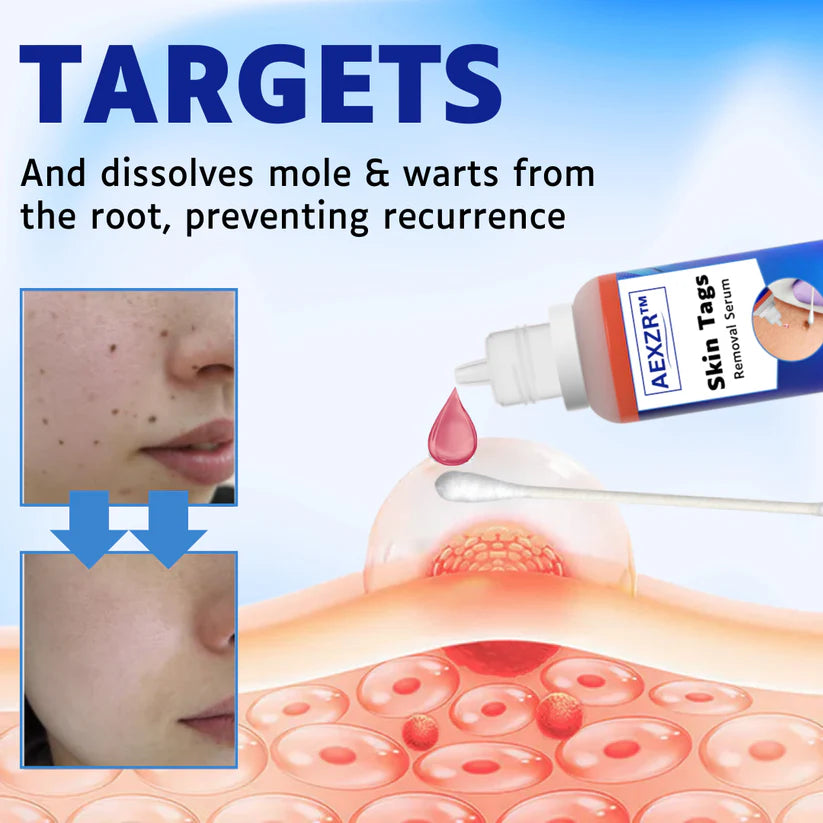 AEXZR™ Skin Tags Removal Serum🌿 Uncover the Skin You Were Born With