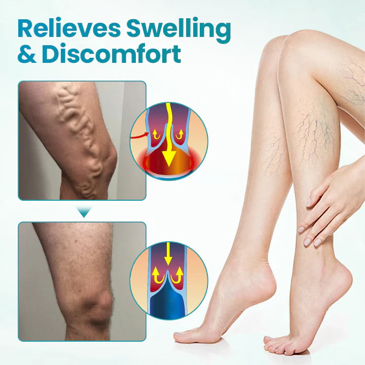 ✅Croaie® VeinAway Relief Cream