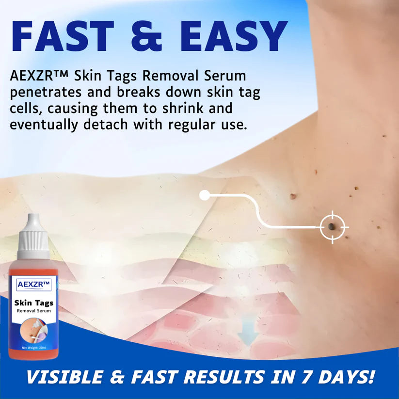 AEXZR™ Skin Tags Removal Serum🌿 Uncover the Skin You Were Born With