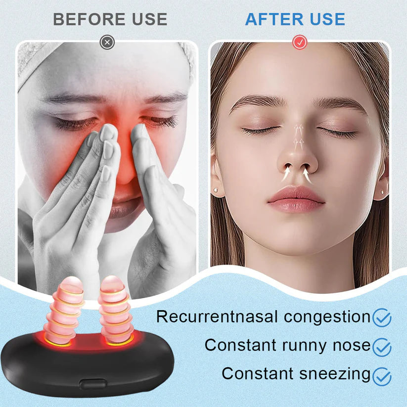 Mresio® 𝐀𝐥𝐥𝐞𝐫𝐠𝐢𝐜 𝐑𝐡𝐢𝐧𝐢𝐭𝐢𝐬 𝐑𝐞𝐥𝐢𝐞𝐟 𝐃𝐞𝐯𝐢𝐜𝐞