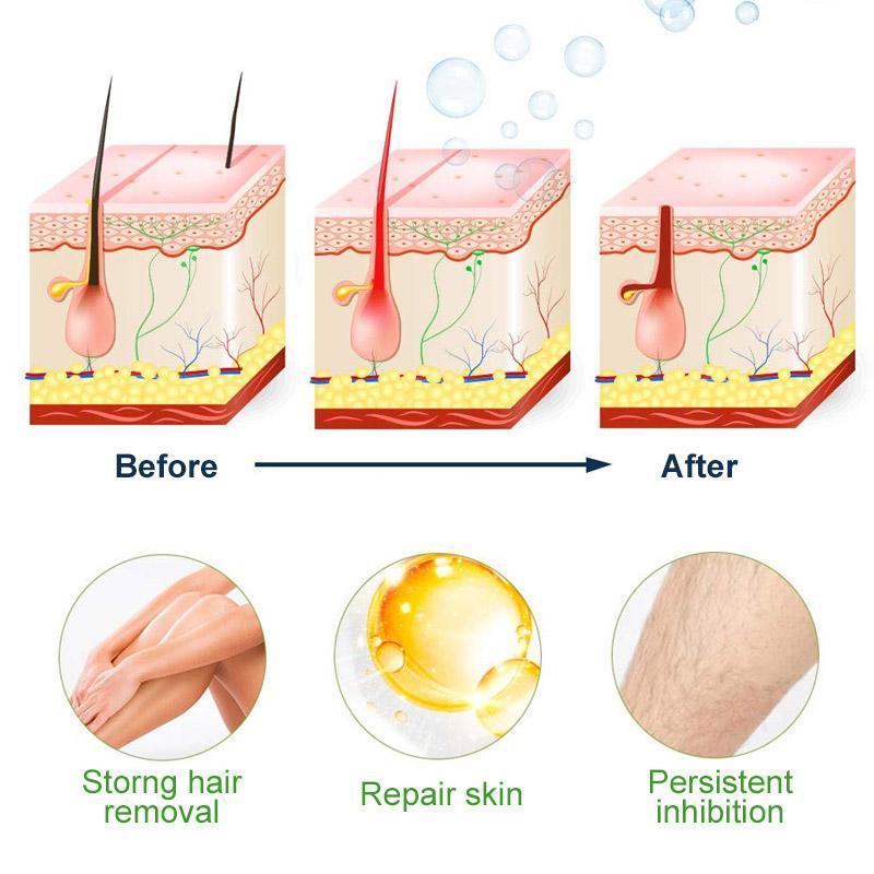 Semi-Permanent Hair Re-moval Spray