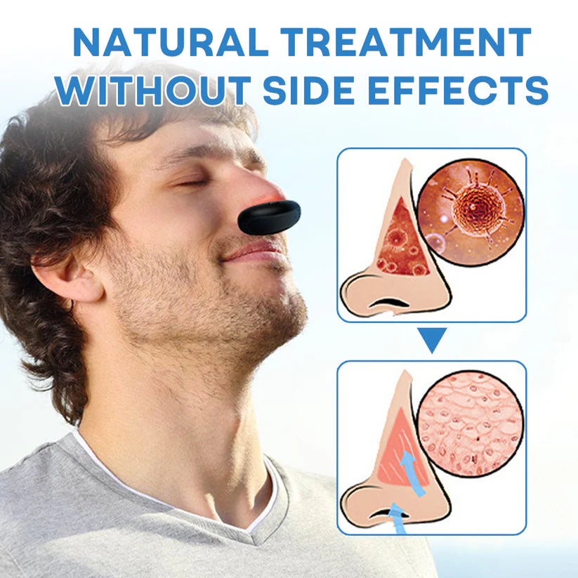 Mresio® 𝐀𝐥𝐥𝐞𝐫𝐠𝐢𝐜 𝐑𝐡𝐢𝐧𝐢𝐭𝐢𝐬 𝐑𝐞𝐥𝐢𝐞𝐟 𝐃𝐞𝐯𝐢𝐜𝐞