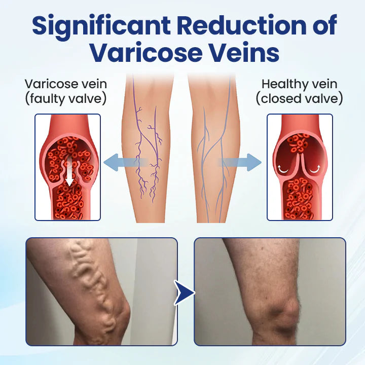 Timilk® Deep Vein Repair Microneedle Patch