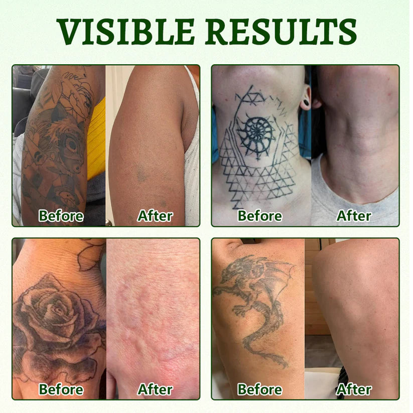 Ceoerty® PureAlgae Ink Removal Support Spray 🌿 — Say Goodbye to Old Tattoo Pigment 💚, Fade Stubborn Ink ✨, Repair & Smooth Treated Skin 💧, Non-Laser ✅, Try It Now! 🔥