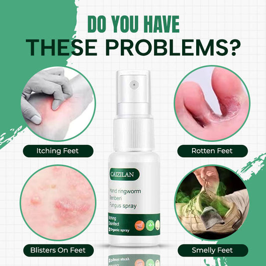 Hand Ringworm Beriberi Fungus Spray