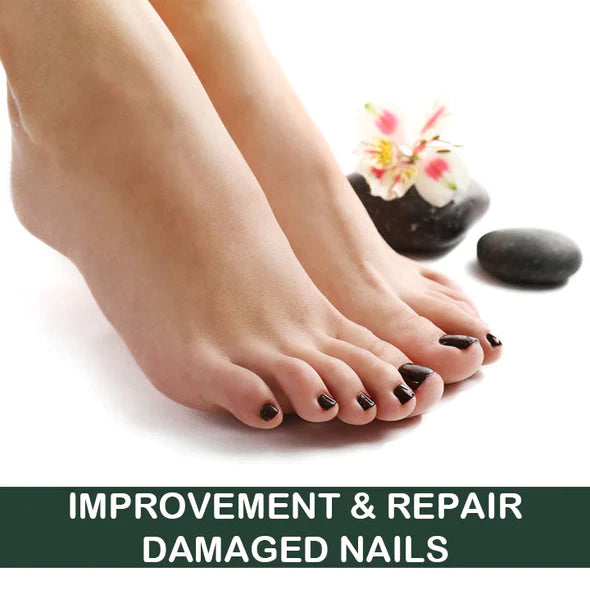 LifeMed Home Use Onychomycosis Fungus Laser Treatment